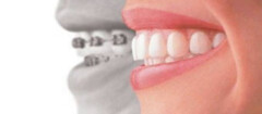 plano-odontologico-sao-jose-dos-campos-1447973036